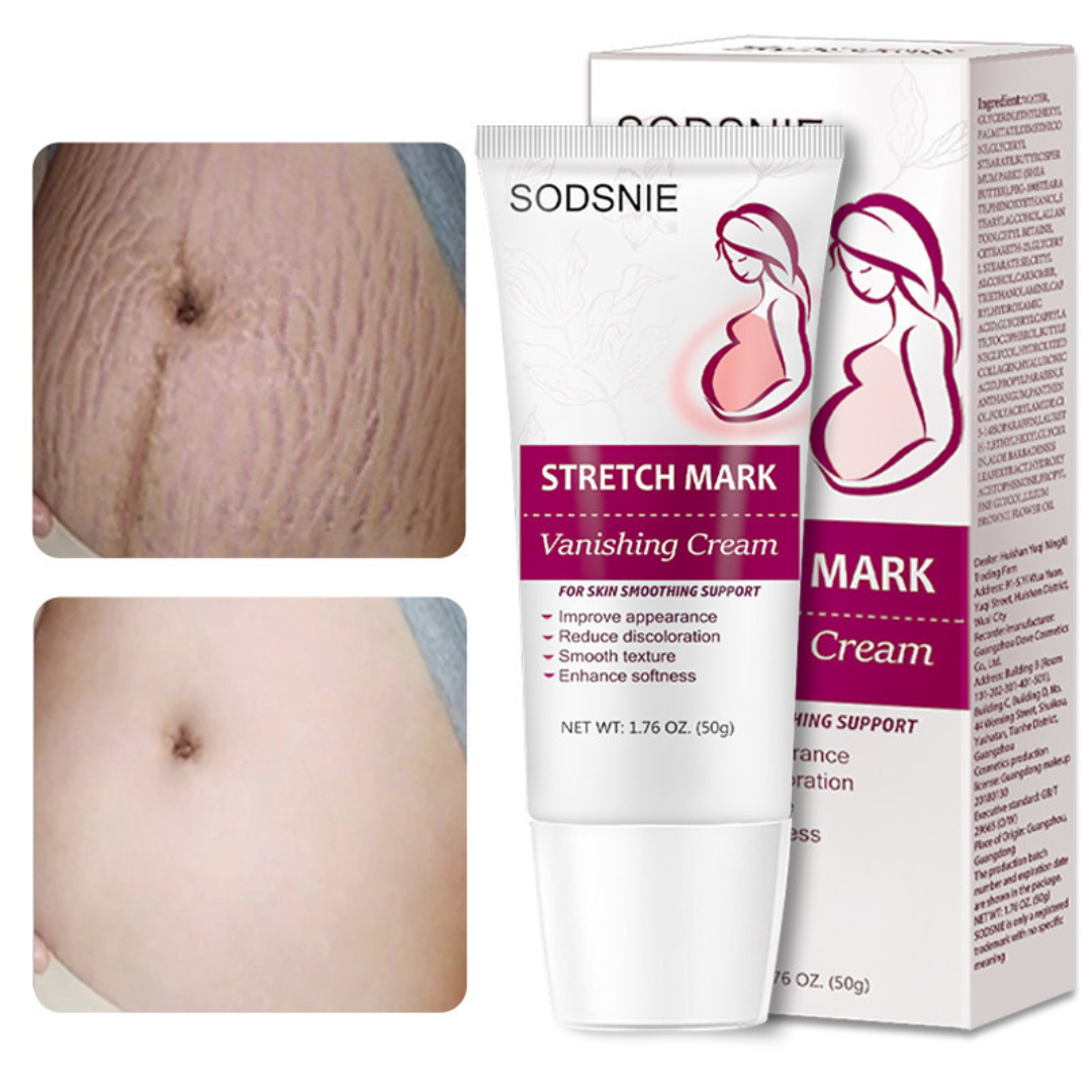 Crema Corporal para el Cuidado de la Piel con Marcas