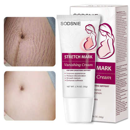 Crema Corporal para el Cuidado de la Piel con Marcas