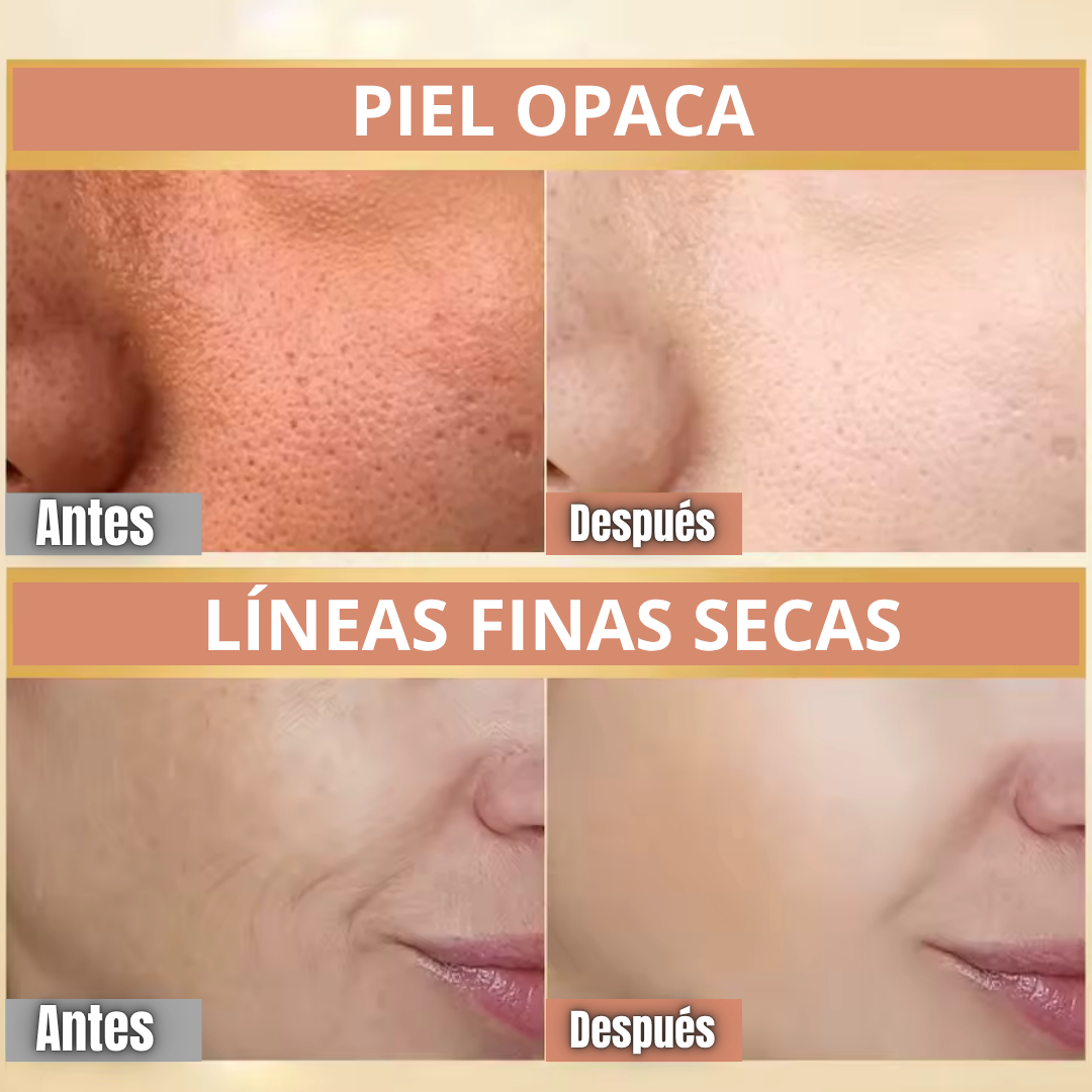 Crema Reafirmante Antiarrugas BeeVenom® [¡Compra 1 y llévate 2!]