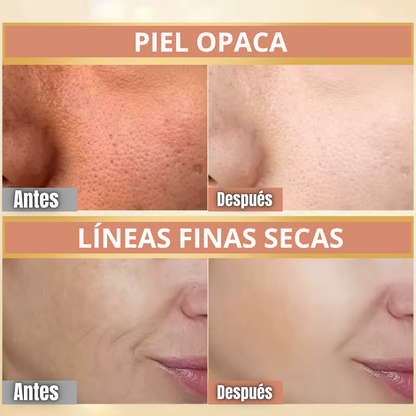 Crema Reafirmante Antiarrugas BeeVenom® [¡Compra 1 y llévate 2!]